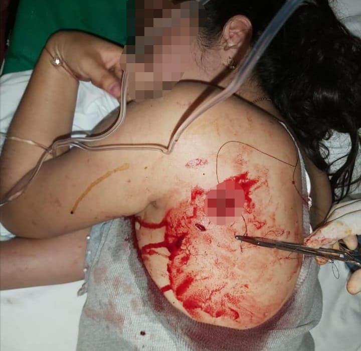 Sigue la violencia feminicida, la víctima presentó denuncia ante la Fiscalía General del Estado y el Ministerio Público no ha hecho nada.