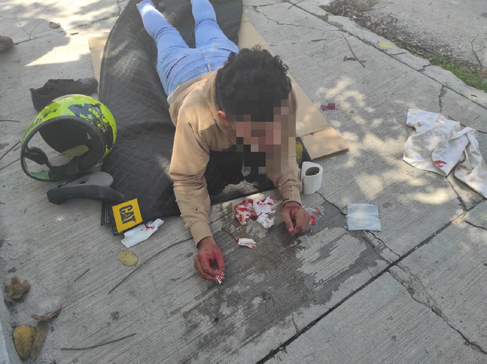 Joven motocicleta pierde el control de su vehículo y se estrella contra una camioneta.